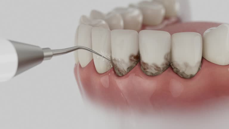Reliable Dental Implants contractor in Ocala, FL by Smile Center Dentistry